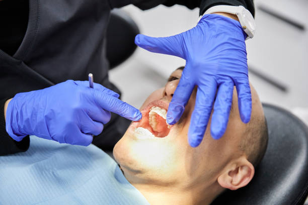 Best Emergency Gum Treatment in Los Banos, CA